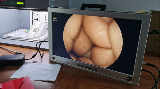 كامل HD 1080P 4 في 1 نظام كاميرا منظار طبي محمول متكامل